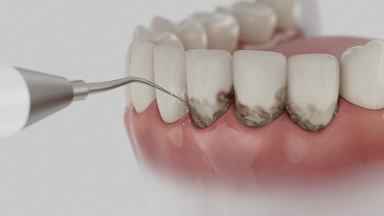 Reliable Dental Implants contractor in Alto, TX by Smile Center Dentistry